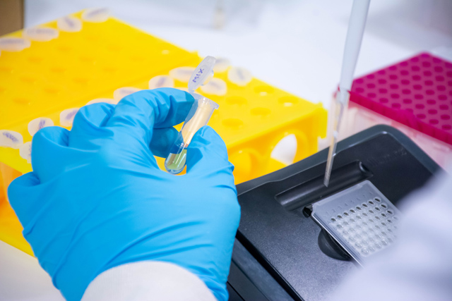 EL TEST DE INMUNIDAD CELULAR QUE TE CUENTA SI NECESITAS VOLVER A VACUNARTE CONTRA LA COVID-19