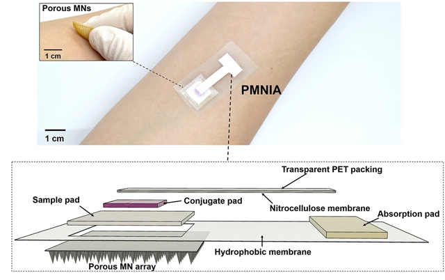 INVENTAN UN PARCHE CON UN TEST DE ANTICUERPOS INCORPORADO