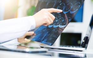 EXOMA DIRIGIDO Y ESTUDIOS DE COSEGREGACIÓN, EL EQUIPO PERFECTO EN DIAGNÓSTICO GENÉTICO: CASO CLÍNICO