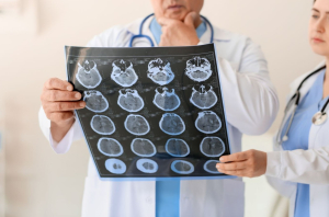 UN CHICO DE 19 AÑOS SE CONVIERTE EN EL PACIENTE MÁS JOVEN CON ALZHÉIMER