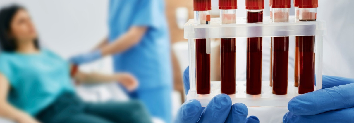 BIOPSIA LÍQUIDA: UNA NUEVA ESPERANZA EN LA DETECCIÓN DEL CÁNCER