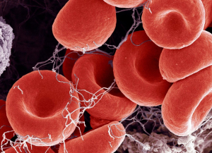 GENÉTICA Y COAGULACIÓN: COMPRENDIENDO LOS FACTORES DE RIESGO HEREDITARIOS DE LA COAGULACIÓN SANGUÍNEA