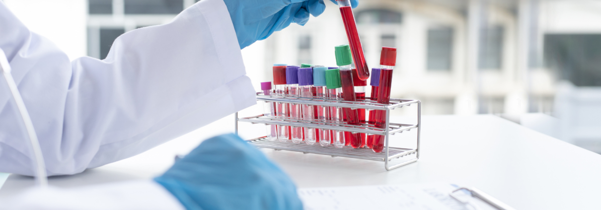 ¿SABES INTERPRETAR LOS INFORMES DE RESULTADOS DE TUS ANALÍTICAS?