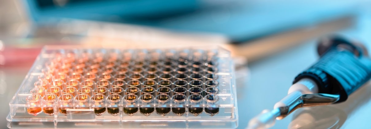 REVOLUCIÓN DIAGNÓSTICA: CÓMO LAS NUEVAS PRUEBAS ESTÁN CAMBIANDO EL DESTINO DE LAS ENFERMEDADES RARAS