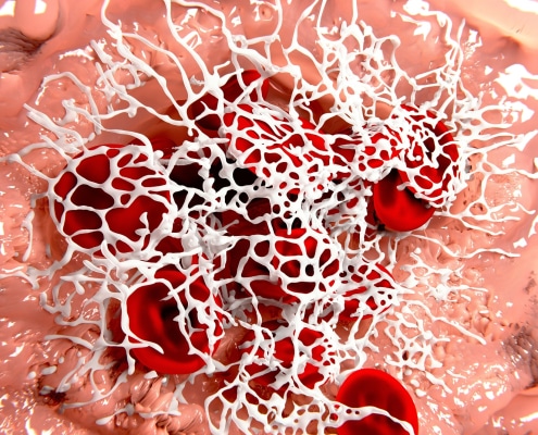 LAS PRUEBAS DEL TEST DE TROMBOFILIA: UNA GUÍA COMPLETA