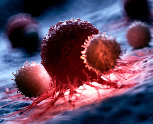 CÁNCER SOMÁTICO: UNA PERSPECTIVA DETALLADA
