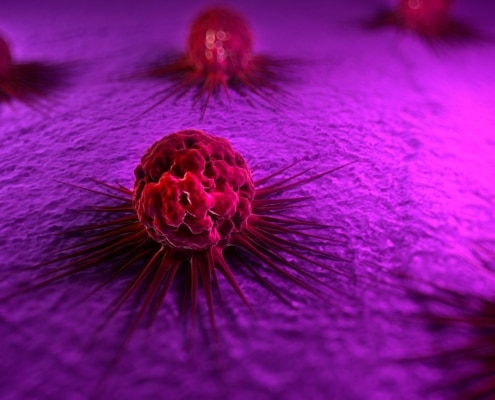 EL IMPACTO DEL ANÁLISIS GENÉTICO EN LA DETECCIÓN PRECOZ DEL CÁNCER