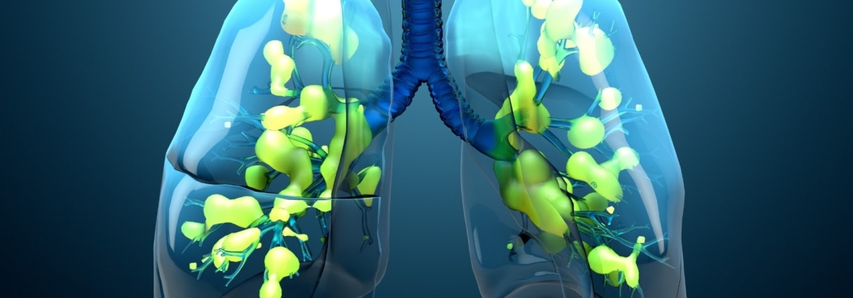 INFECCIONES RESPIRATORIAS: CAUSAS, DIAGNÓSTICO, TRATAMIENTOS Y SU RELACIÓN CON LA GENÉTICA