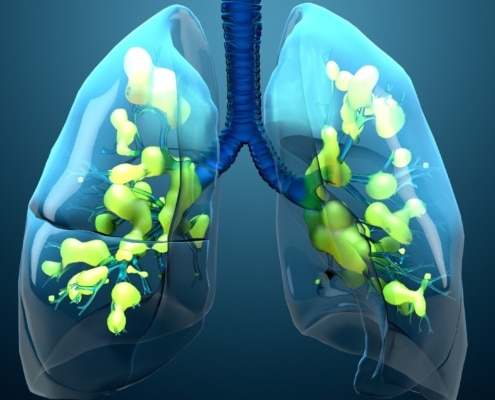 INFECCIONES RESPIRATORIAS: CAUSAS, DIAGNÓSTICO, TRATAMIENTOS Y SU RELACIÓN CON LA GENÉTICA