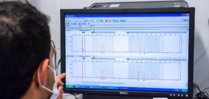 LA INFLUENCIA DE VARIANTES GENÉTICAS EN LA PREDISPOSICIÓN A ENFERMEDADES NEURODEGENERATIVAS