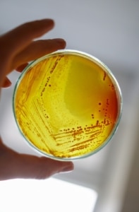 ¿QUÉ ES EL METAGENOMA Y POR QUÉ ESTÁ REVOLUCIONANDO LA MEDICINA?