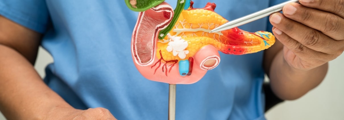 PANCREATITIS: CUANDO TU PÁNCREAS HABLA, TAMBIÉN LO HACE TU GENÉTICA