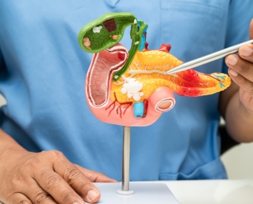 PANCREATITIS: CUANDO TU PÁNCREAS HABLA, TAMBIÉN LO HACE TU GENÉTICA