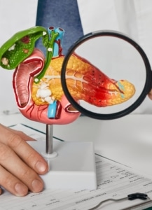 PANCREATITIS: CUANDO TU PÁNCREAS HABLA, TAMBIÉN LO HACE TU GENÉTICA