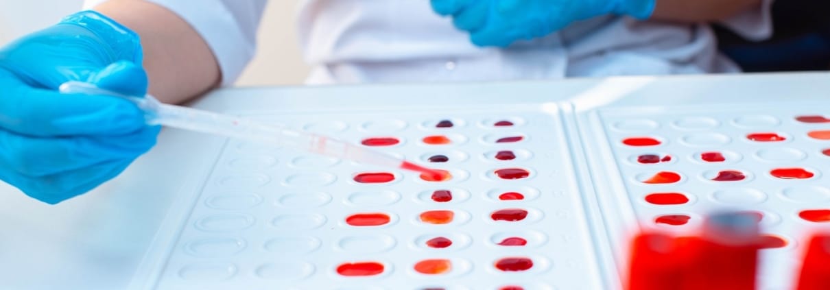 GRUPOS SANGUÍNEOS: LO QUE REVELA TU SANGRE Y CÓMO SE DETERMINA CON UNA PRUEBA