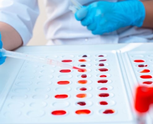 GRUPOS SANGUÍNEOS: LO QUE REVELA TU SANGRE Y CÓMO SE DETERMINA CON UNA PRUEBA