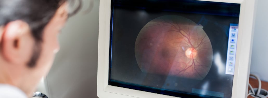 AMAUROSIS CONGÉNITA DE LEBER: CÓMO LA GENÉTICA ILUMINA ESTA FORMA DE CEGUERA INFANTIL