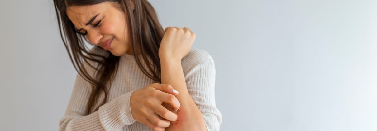 PSORIASIS Y GENÉTICA: CÓMO LA HERENCIA INFLUYE EN ESTA ENFERMEDAD Y QUÉ NOS REVELAN LOS ESTUDIOS ACTUALES