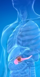 MARIANO BARBACID Y EL CÁNCER DE PÁNCREAS: QUÉ SIGNIFICA REALMENTE EL ÚLTIMO AVANCE CIENTÍFICO