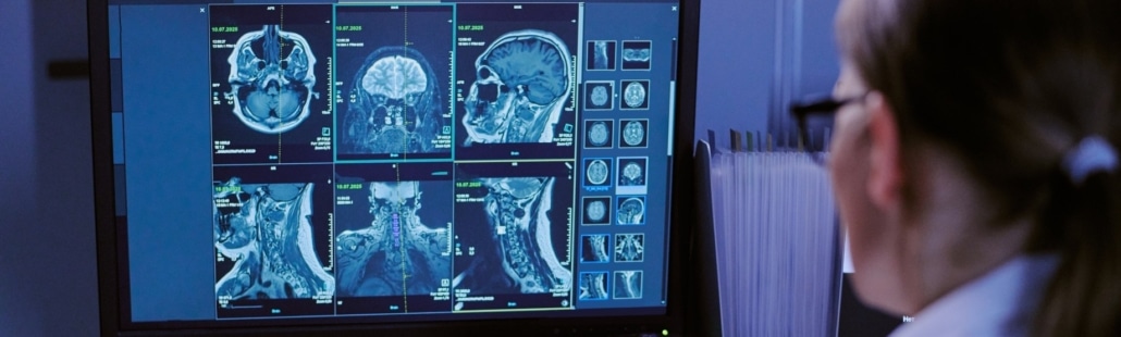 POR QUÉ ALGUNOS TRASTORNOS NEUROLÓGICOS EMPEORAN CON LA EDAD