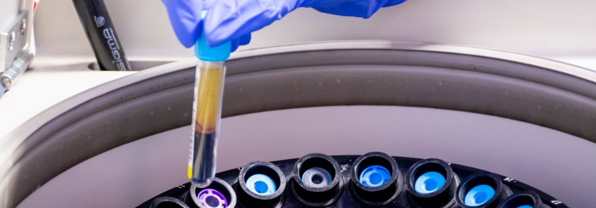 De la muestra al informe: el recorrido de una prueba genética en el laboratorio