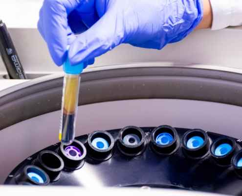 De la muestra al informe: el recorrido de una prueba genética en el laboratorio