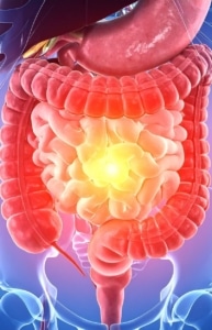 GENÉTICA Y MICROBIOMA: LA RELACIÓN ENTRE TUS GENES Y TU FLORA INTESTINAL