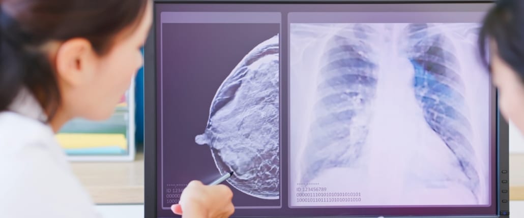 POR QUÉ ALGUNAS PERSONAS DESARROLLAN CÁNCER SIN ANTECEDENTES FAMILIARES